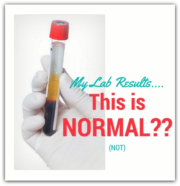 Thyroid Laboratory Test Results Chart