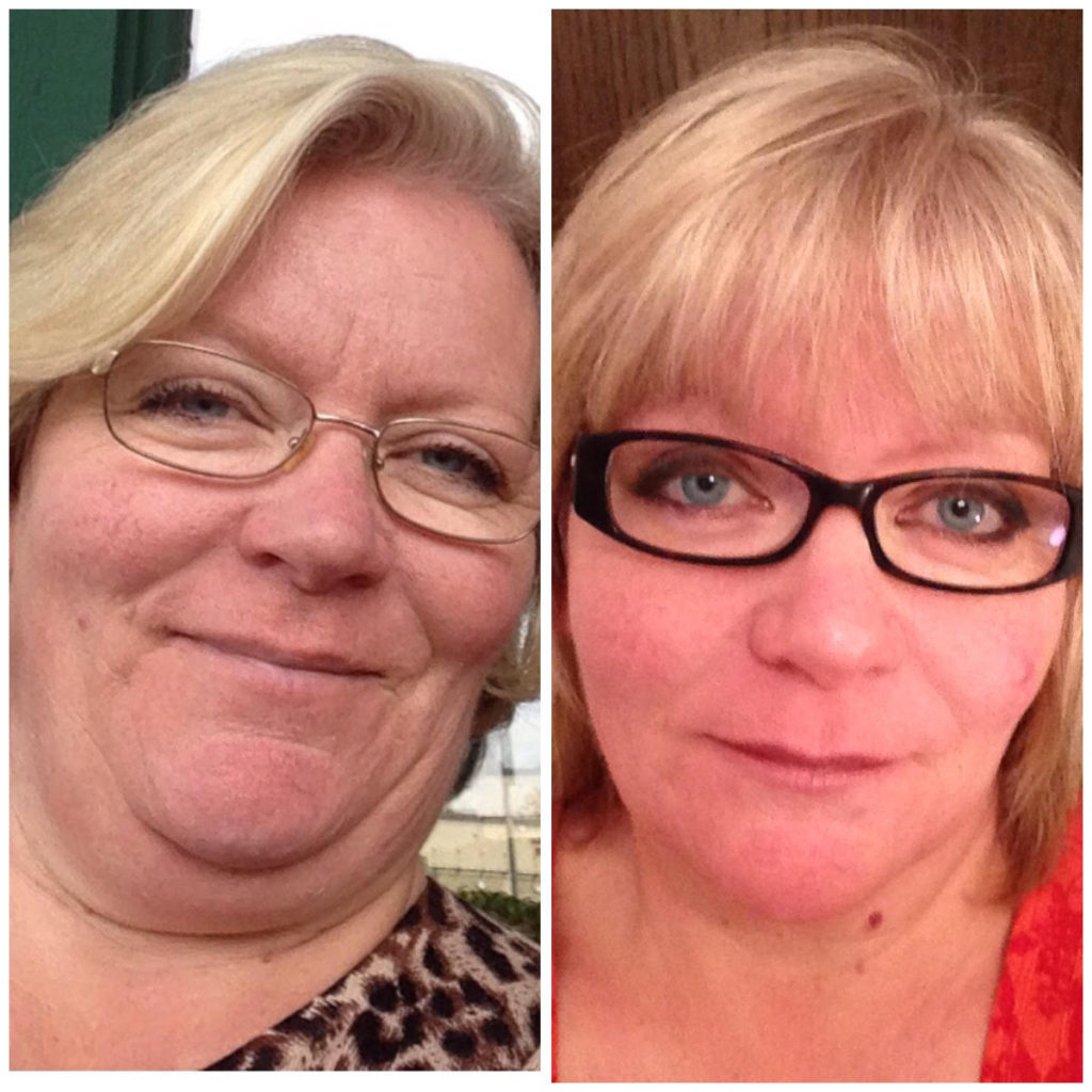 hypothyroid-in-photos-before-and-after-stop-the-thyroid-madness