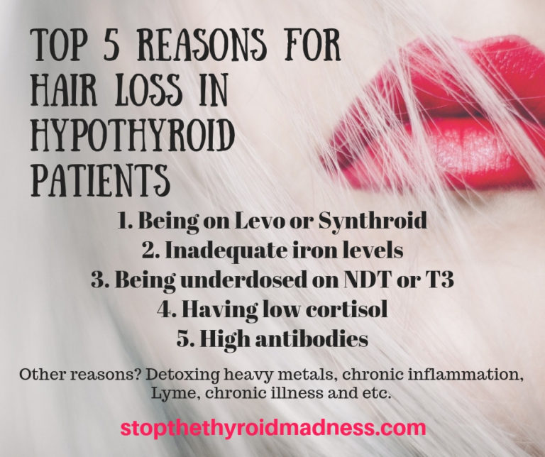 help-i-have-hair-loss-stop-the-thyroid-madness