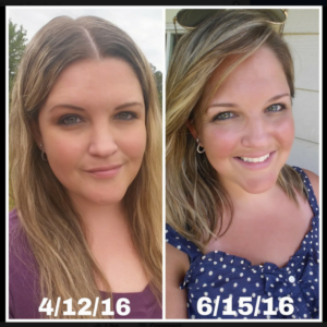 Hypothyroid in photos-Before and After - Stop The Thyroid Madness