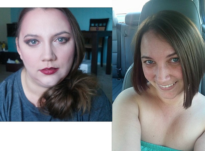 hypothyroidism before and after face