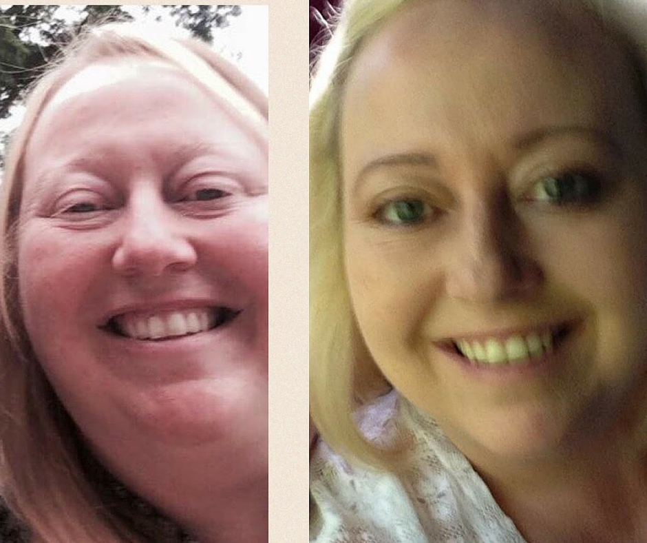 Before After Sharon Cuthbert of the UK