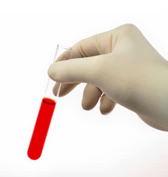 A hand wrapped in a glove, holding a test tube full of red liquid