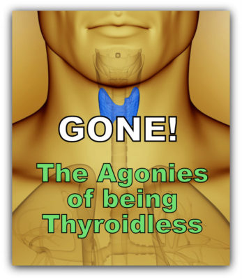 agonies being thyroidless and man with thyroid highlighted in blue color